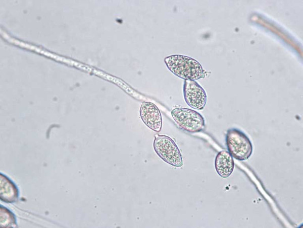 Obr. 4: Sporangia Phytophthora infestans (www.vegetables.cornell.educropspotatoeslate-blight)