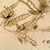 Choroby brukvovitých olejnin: Skvrnitosti řepky