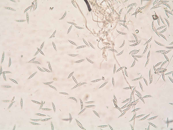 Obr. 4: Makrokonidie Fusarium spp.