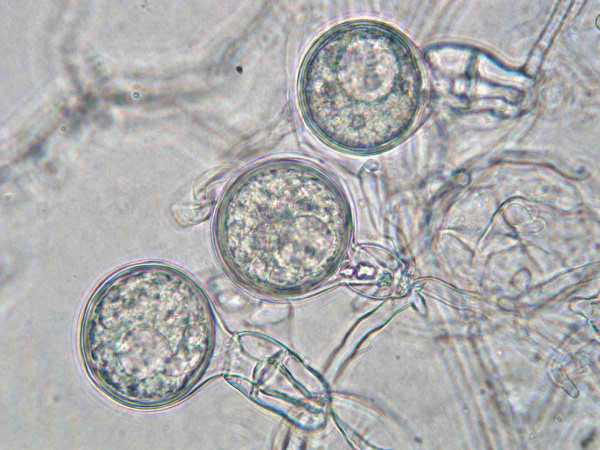 Obr. 3: Pohlavní orgány druhu Phytophthora cinnamomi