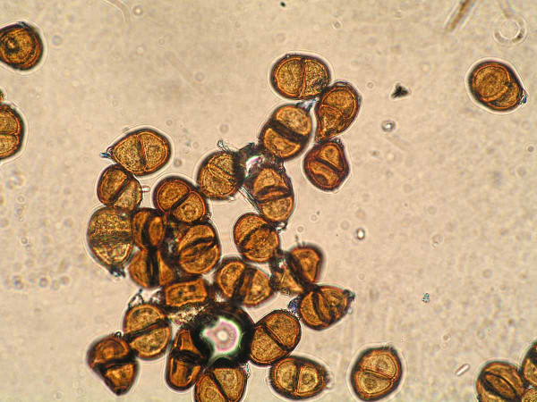 Teliospory Puccinia carthami  (mikroskop)