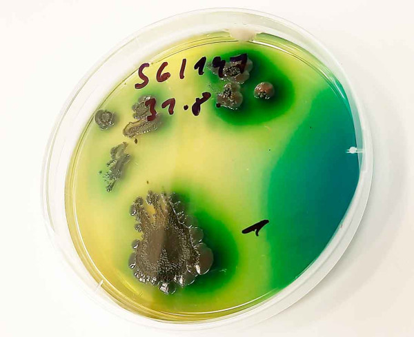 Obr. 8: Symbiotické bakterie Xenorhabdus khoisanae jsou potravou hlístovky Steinernema beitlechemi, původem z Jihoafrické republiky