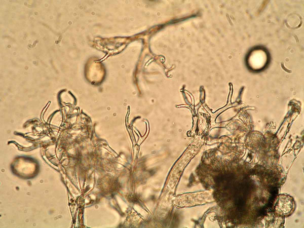 Hyaloperonospora parasitica  - sporangiofor, sporangia