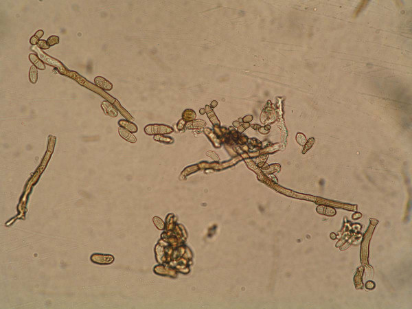 Konidie rodu Cladosporium