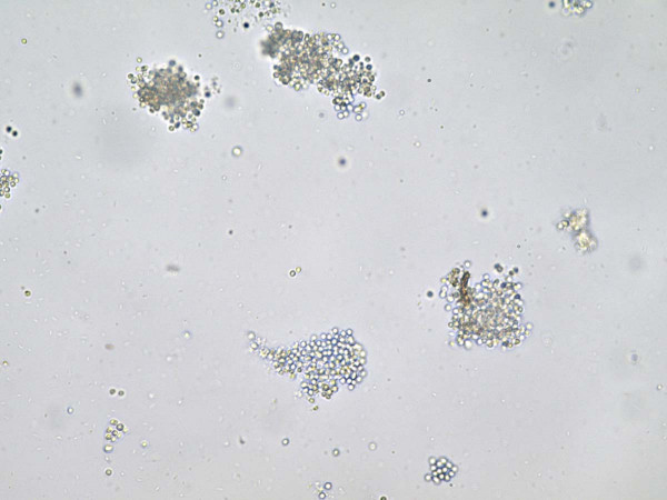 Obr. 1: Mikroskopický snímek spor P. brassicae po jejich uvolnění z pletiv nádoru na kořeni; velikost spor se pohybuje okolo 3–4 µm (zvětšení 400×)