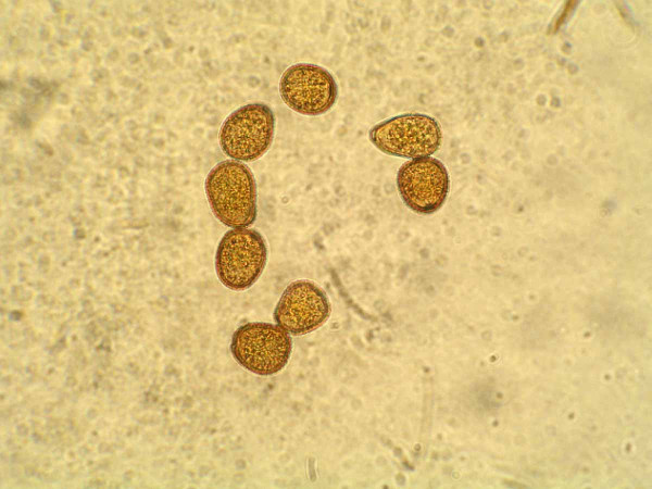 Patogen Puccinia helianthi - uredospory
