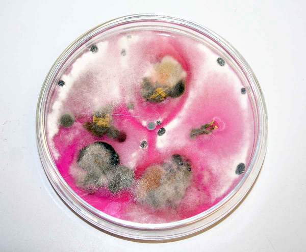 Obr. 2: Sklerocia jsou útvary hrudkovitého či ledvinovitého charakteru v bílém myceliu při petal testech při růstu na agarovém médiu