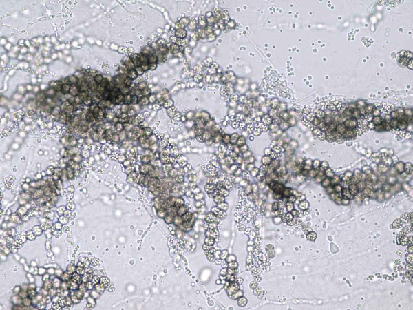 Mikrosklerocia Verticillium longisporum v mikroskopu