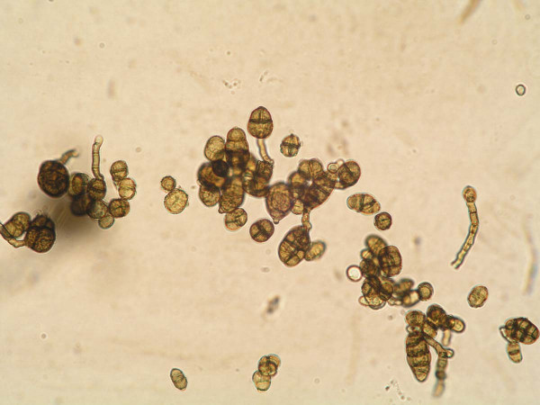 Konidie rodu Stemphylium