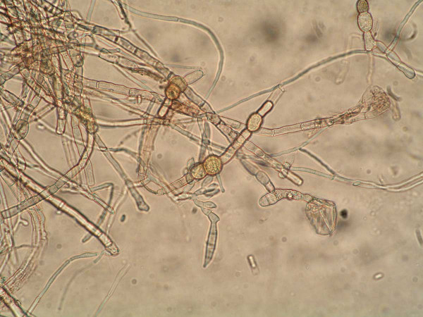 Obr. 5: Mycelium Fusarium spp.