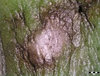 Detail skvrny způsobené houbou Septoria silybi