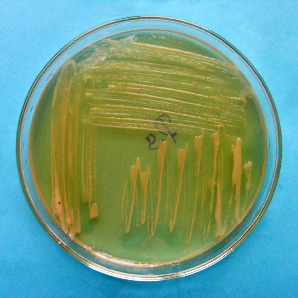 Kolonie bakterie Ralstolnia solanacearum