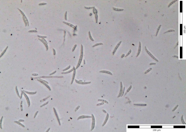 Makrokonidie Fusarium spp.