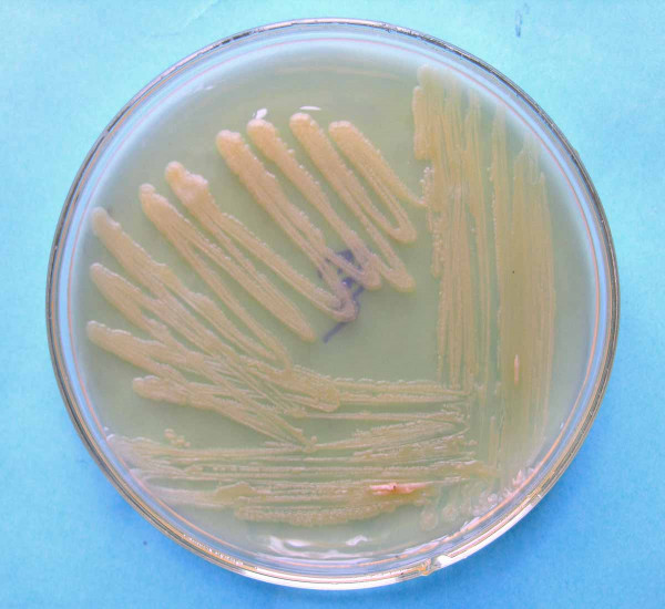 Kolonie bakterií Pectobacterium carotovorum