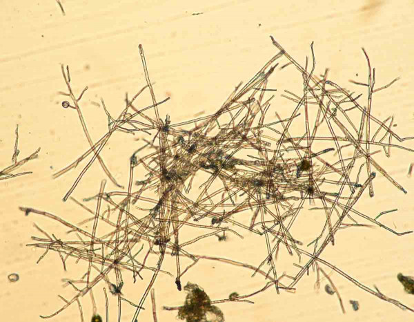 Mycelium, sporangiofory Phytophthora infestans