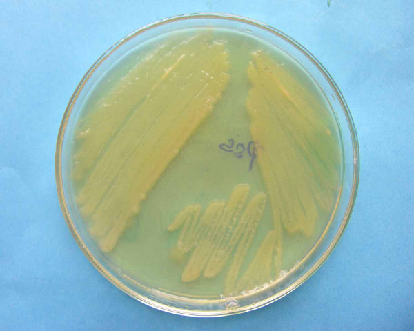 Kolonie bakterií rodu Pseudomonas