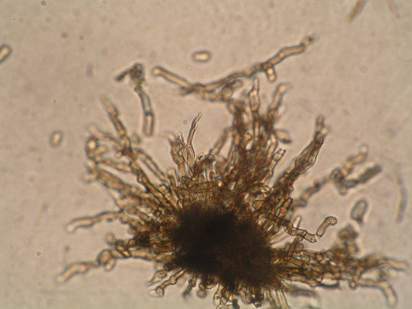Konidiofory rodu Cladosporium