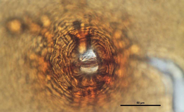 Háďátko řepné (Heterodera schachtii) - detail cysty