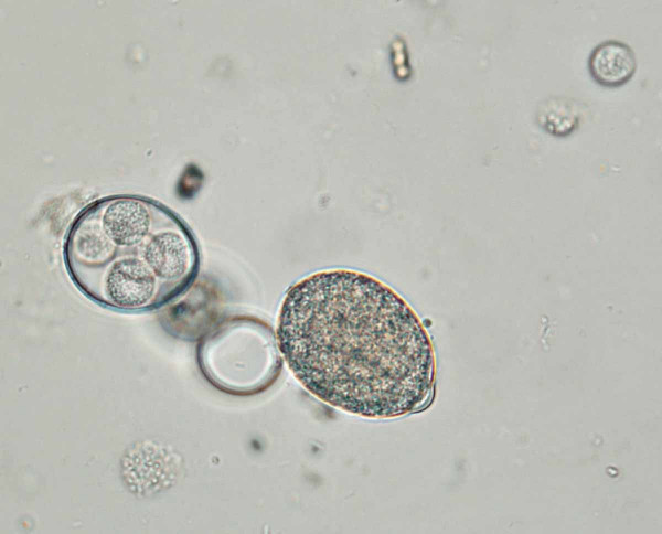 Obr. 1: Mikrofotografie Plasmopara halstedii - vlevo sporangium, ve kterém je již vytvořeno 5 zoospor, krátce před uvolněním