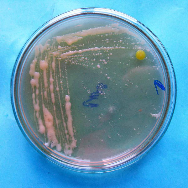 Kolonie bakterie Clavibacter michiganensis subsp. sepedonicus