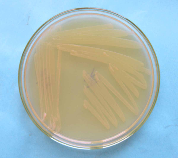 Kolonie bakterií Rhizobium radiobacter