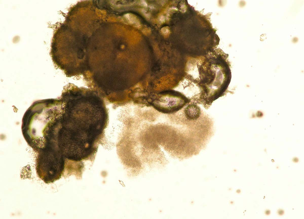 Phoma lingam - pyknidy a spory pod mikroskopem