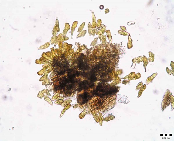 Puccinia striiformis - teliospory