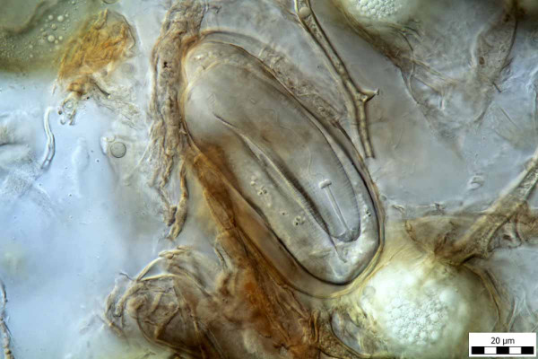 Embryon parazitovaný houbou v cystě