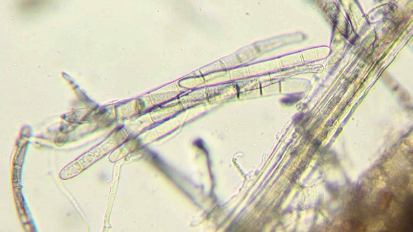 Výtrusy Drechslera tritici-repentis z listu pšenice