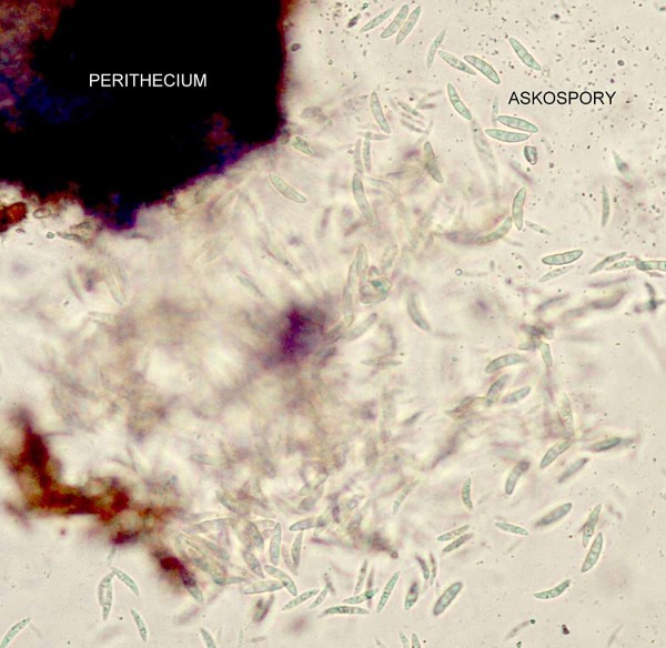 Obr. 4: Zralé askospory uvolněné z perithecia