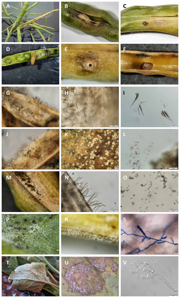 Obr. 1: Komplex faktorů podílejících se na praskání šešulí řepky olejky; A, B - symptomy poškození šešulí na terminálu, C - místo vstupu hmyzu do šešule, D - larva krytonosce šešulového mezi semeny, E, F - začátek růstu mycelia hub v místě narušení pletiva hmyzem, G–I - sporulující mycelium Alternaria spp. (H - detail spor A. brassicicola a I - A. brassicae), J–L - sporulující mycelium a detail spor Botrytis cinerea, M–O - sporulující mycelium a detail spor Cladosporium spp., P–S - sporulující mycelium a detail konidioforu Erysiphe cruciferarum, T–V - příznaky, sporulující mycelium a detail sporangioforu Hyaloperonospora parasitica