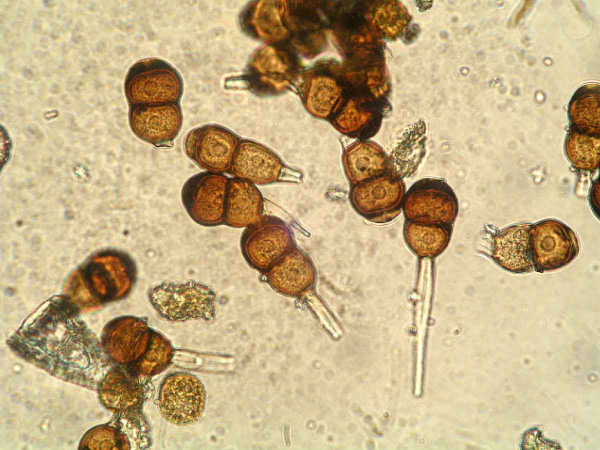 Patogen Puccinia helianthi - teliospory