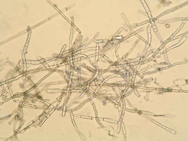 Houba Rhizoctonia solani - mycelium