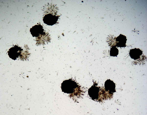 Obr. 3: Perithecia s vřecky naplněnými askosporami, 2020