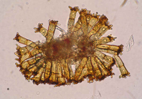 Puccinia coronata - teliospory