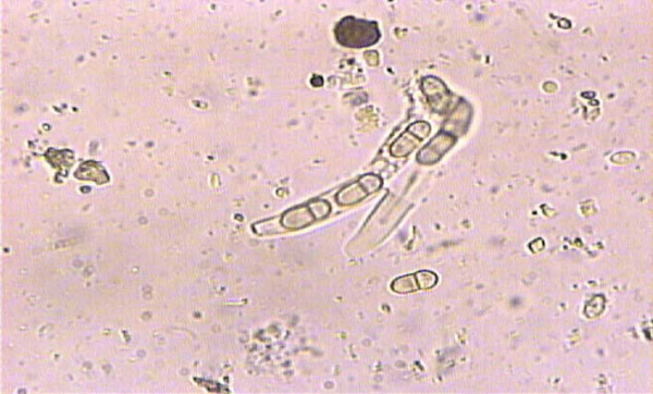 Obr. 5: Samovolné uvolňování askospor z vřecek