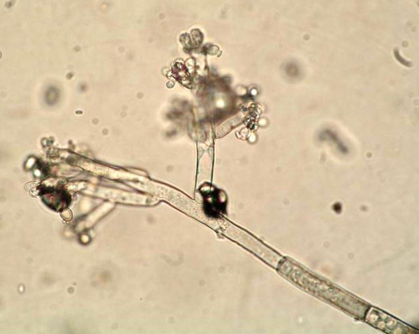 Patogen Botrytis cinerea v mikroskopu