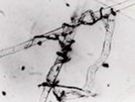 Obr. 2: Parazitace Trichoderma harzianum na hyfách Sclerotinia sclerotiorum