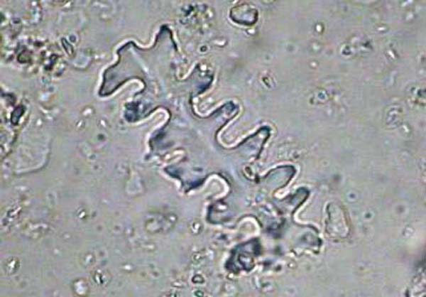 Obr. 1 Fytolit v rostlinné buňce (zdroj: lape.prf.jcu.cz/oblasti-zajmu/fytolity/)