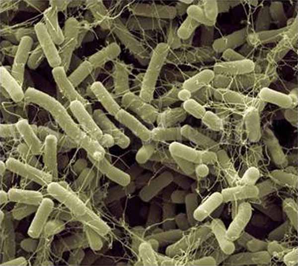 Obr. 1: Mikroskopický snímek Bacillus amyloliquefaciens (zdroj: pixels.com) 