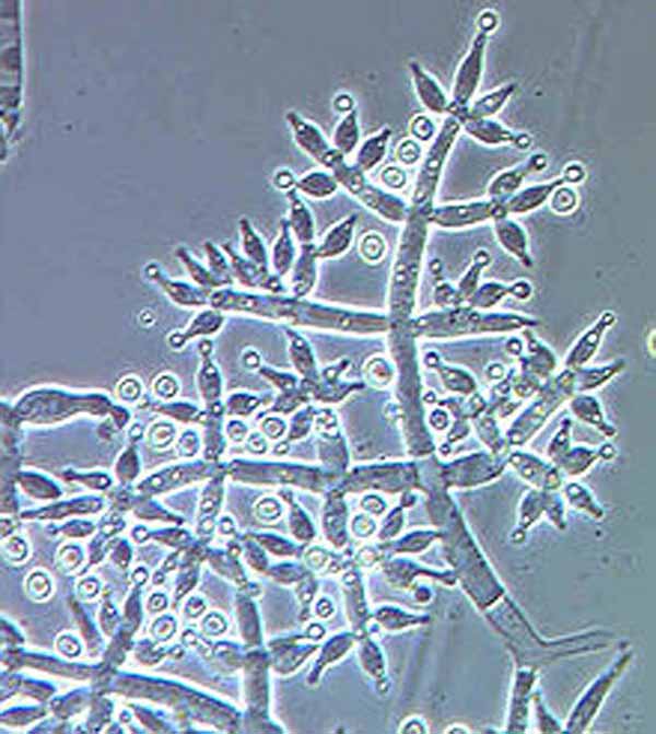 Obr. 2: Mikroskopický snímek Trichoderma harzianum (zdroj: wikimedia.org)