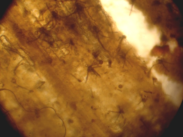 Mikroskopický snímek acervul Colletotrichum sublineolum z povrchu napadeného listu čiroku, (ÚKZÚZ Lednice, 2011)
