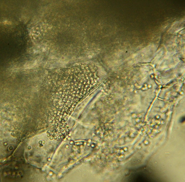 Shluky trvalých výtrusů Plasmodiophora brassicae uvnitř napadených buněk kořene