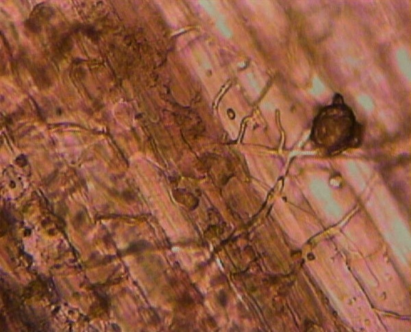 Mikroskopický snímek mycelia Rhizoctonia spp. z pletiva listové pochvy pšenice ozimé